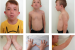 Trisomy D
