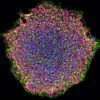 Induced Pluripotent Stem Cells