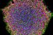 Induced Pluripotent Stem Cells