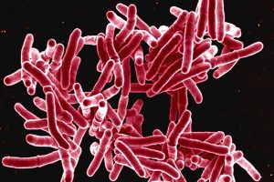Drug Resistant Tuberculosis