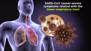 Severe Acute Respiratory Syndrome