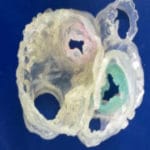 First 3D anatomic heart model printed using multiple imaging techniques
