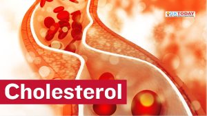 Cholesterol