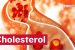 Cholesterol