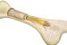 Bone Marrow