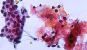 Cytopathology
