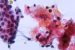 Cytopathology