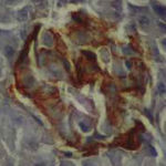 Endosulfan causes DNA damage in animals: Study