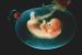 Amniotic Sac