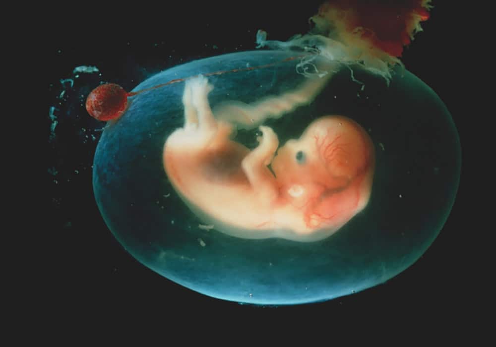 Amniotic Sac
