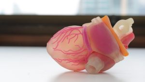 Artificial Organ