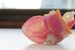 Artificial Organ