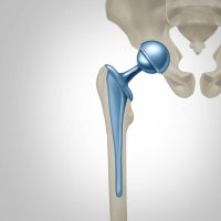 Ball and Socket Joint