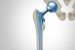 Ball and Socket Joint