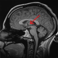 Thalamus