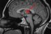 Thalamus
