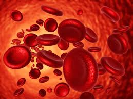 Anemia