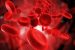 Hemoglobinopathy