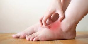 Inflammation