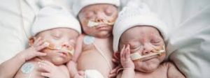 Multiple Birth