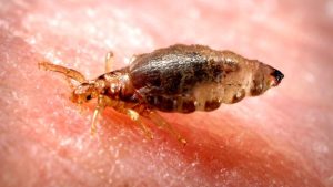 Epidemic typhus