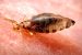 Epidemic typhus