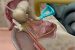 Inner ear