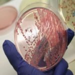 Scientists for first time grow skeletal muscle tissue from stem cells