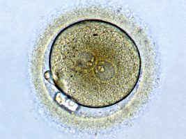 Zygote