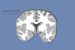 Grey matter