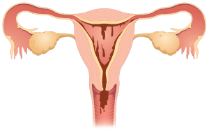 Menstruation