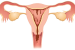 Menstruation