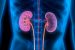 Nephrology
