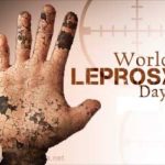 28 January 2018: World Leprosy Day