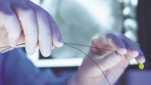 NPPA increases stent prices by around 2%