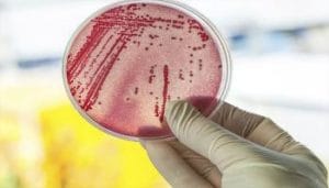 Scientists discover new therapy to prevent sepsis in new born babies
