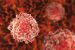Leukemia