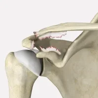 Ligament