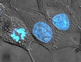 Cell nucleus