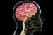 Central nervous system