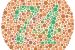 Color blindness