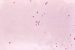Gram negative bacteria