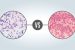 Gram positive bacteria