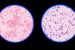 Gram stain