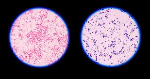 Gram stain