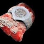 Scientists perform world's first 3D, colour X-ray on human body