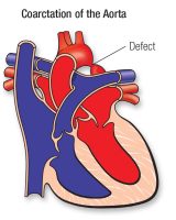 Aorta