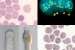 Apicomplexa