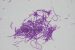 Bacillus thuringiensis