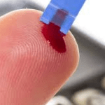 Study shows Albumin as better indicator of Diabetes